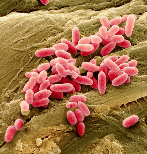 Pseudomonas Aeruginosa